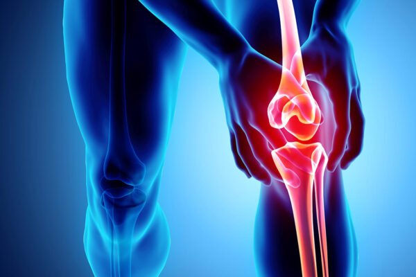 Joint Replacement Surgery